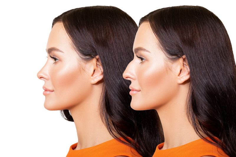 What Our Nose Shapes Reveal About Us! Which One Are You?